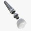 3D Dental Implant