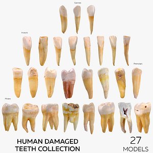 Human Damaged Teeth Collection  - 27 models