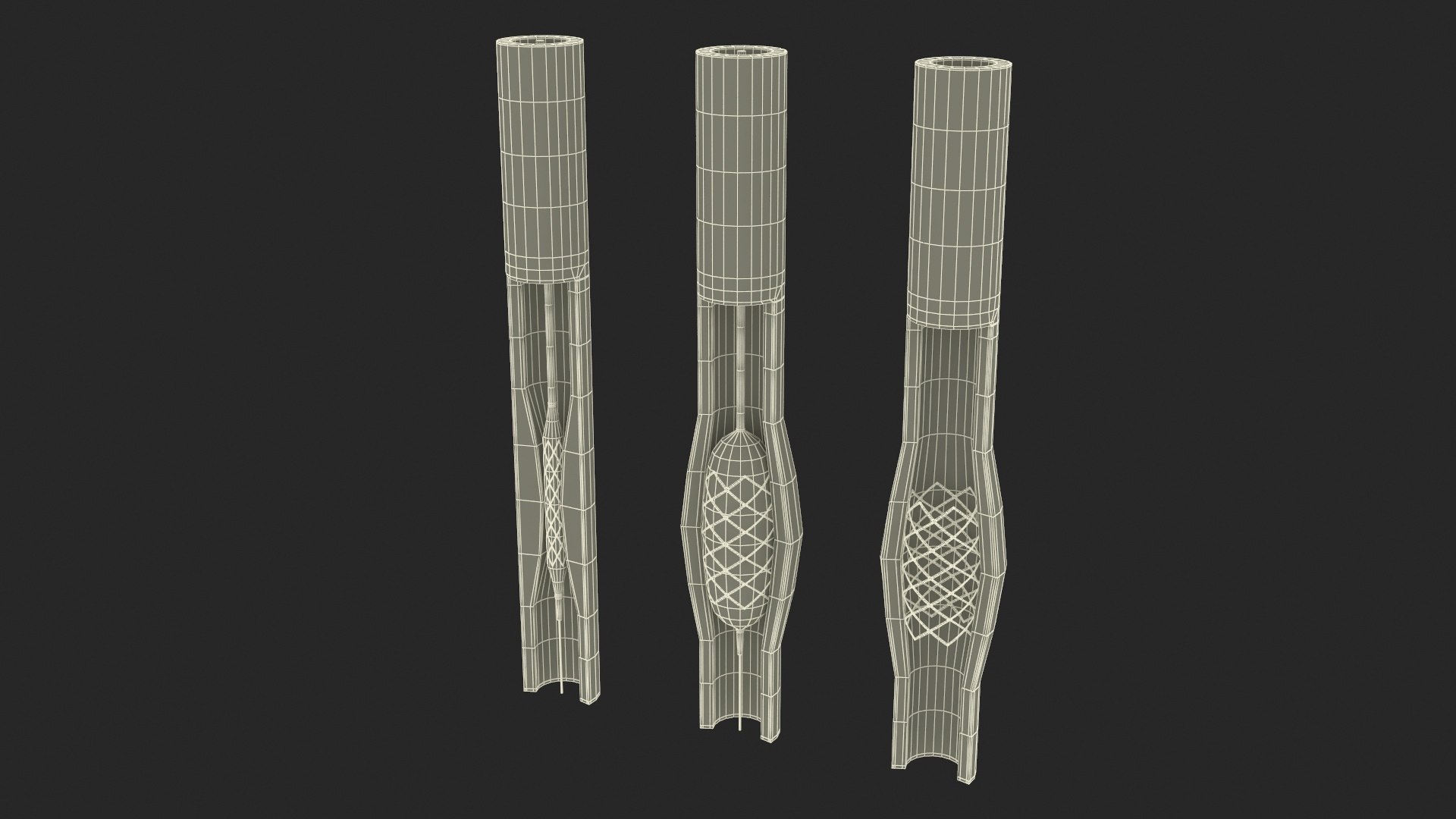 Stents with Artery 3D model https://p.turbosquid.com/ts-thumb/yY/zWgJhC/79/stentswitharteryvray3dmodel027/jpg/1717837266/1920x1080/fit_q87/8aebfe1fbd9ed7870c7afabd86e1aac83cfd6cbe/stentswitharteryvray3dmodel027.jpg