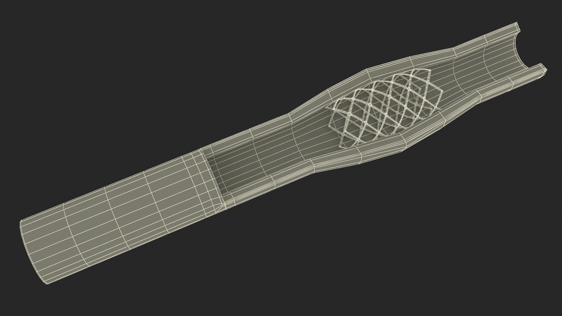 Stents with Artery 3D model https://p.turbosquid.com/ts-thumb/yY/zWgJhC/8P/stentswitharteryvray3dmodel031/jpg/1717837278/1920x1080/fit_q87/3569039183624b320894614af314aca57d244aa1/stentswitharteryvray3dmodel031.jpg