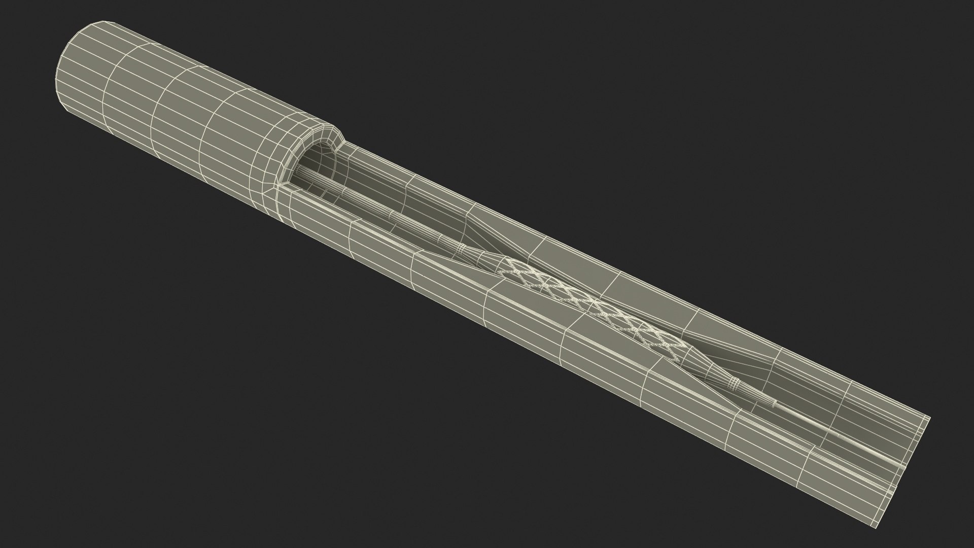Stents with Artery 3D model https://p.turbosquid.com/ts-thumb/yY/zWgJhC/Jq/stentswitharteryvray3dmodel032/jpg/1717837281/1920x1080/fit_q87/f61b17a0760e23b41038b1518ebe5282189f358c/stentswitharteryvray3dmodel032.jpg