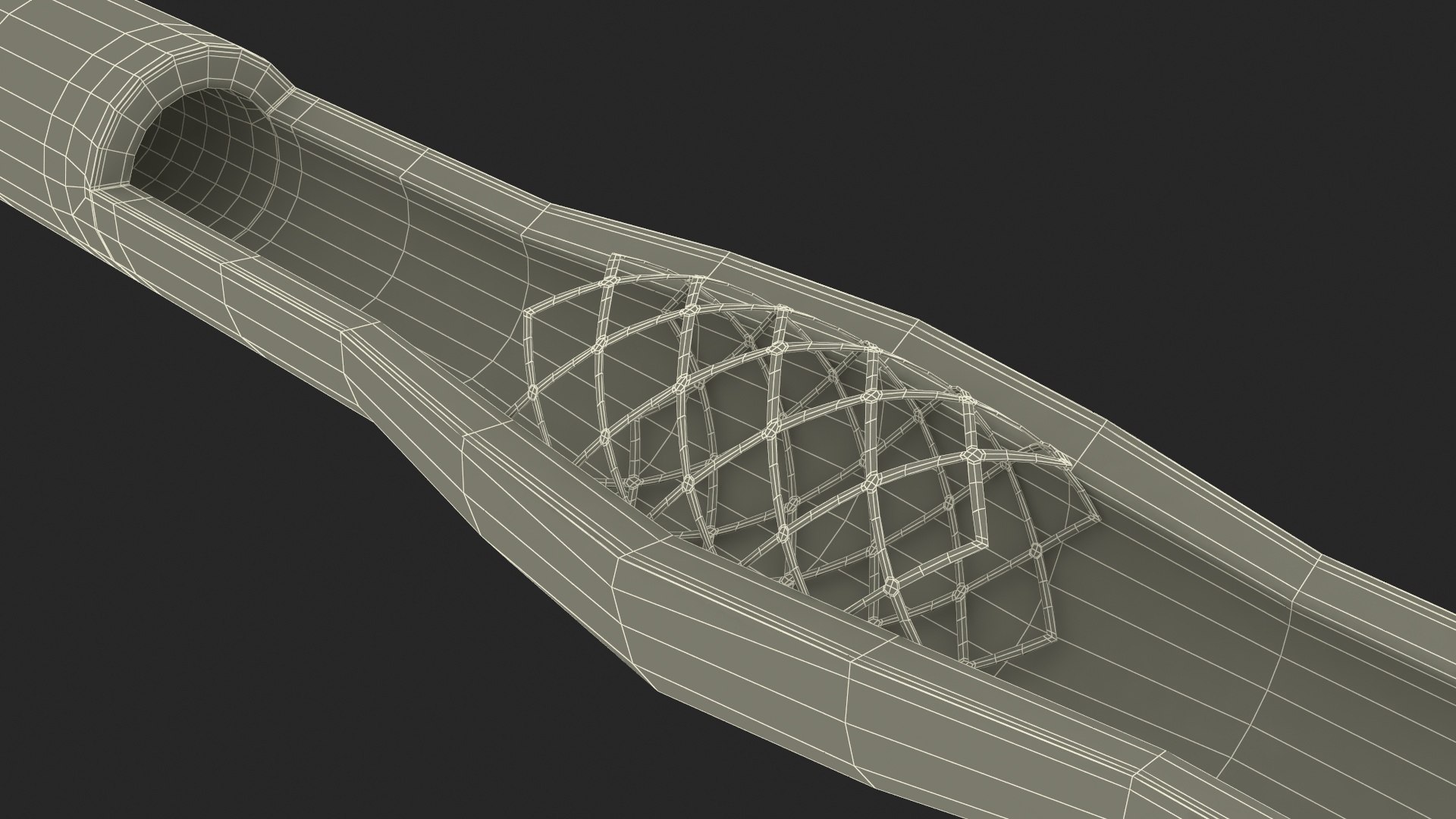 Stents with Artery 3D model https://p.turbosquid.com/ts-thumb/yY/zWgJhC/Wv/stentswitharteryvray3dmodel034/jpg/1717837287/1920x1080/fit_q87/15ce909bf4f5d697736e6e08e281ec80e280e21b/stentswitharteryvray3dmodel034.jpg