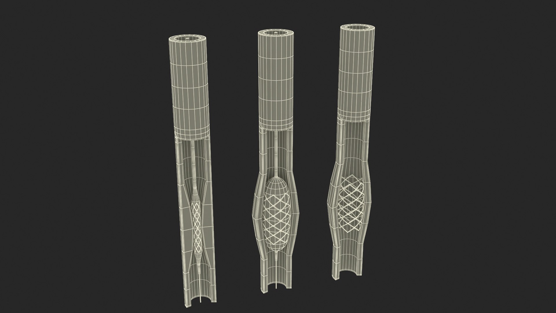 Stents with Artery 3D model https://p.turbosquid.com/ts-thumb/yY/zWgJhC/pI/stentswitharteryvray3dmodel026/jpg/1717837263/1920x1080/fit_q87/ac0a833813763fc96d7279fd01d9fd5ac8860b98/stentswitharteryvray3dmodel026.jpg