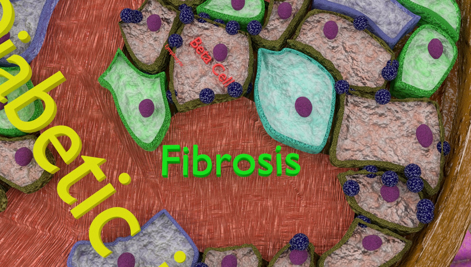 Pancreas Diabetes Anatomy Islets Model - TurboSquid 1409362