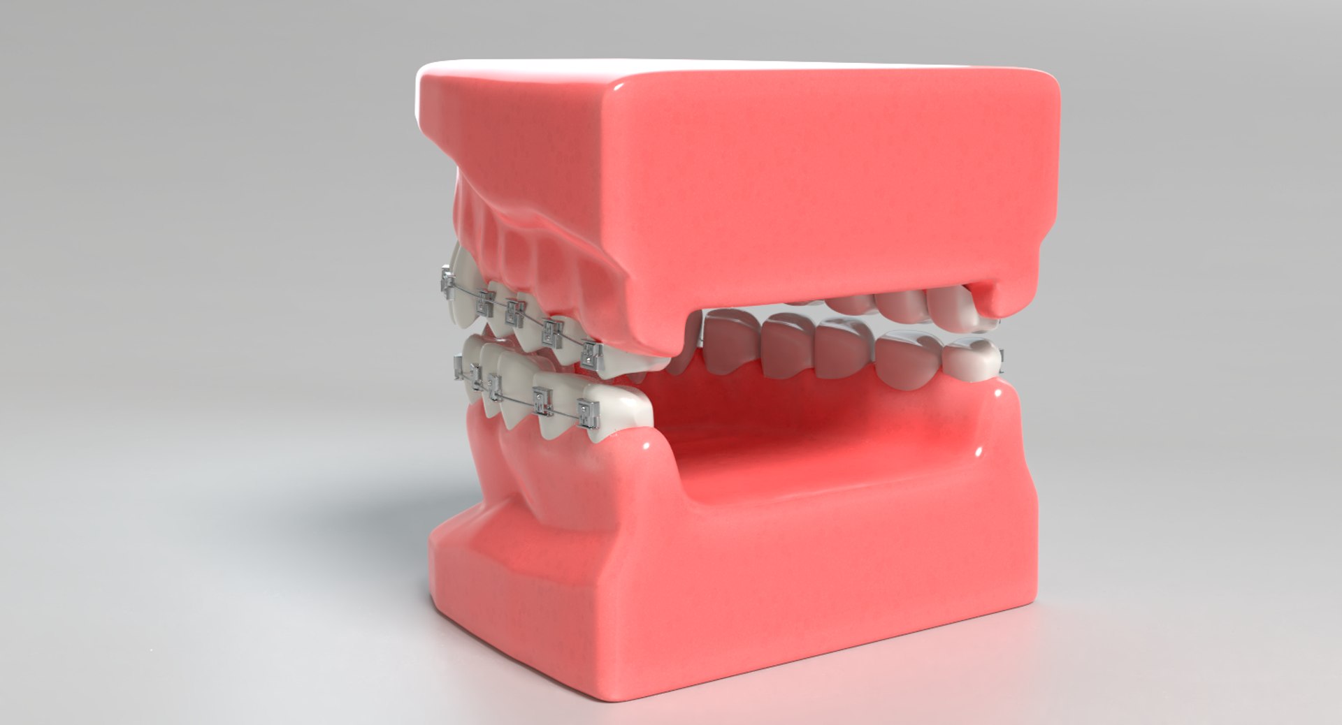 3D mouth braces modeled model https://p.turbosquid.com/ts-thumb/yn/mCjnvL/CVEC09sM/images0021/png/1517861415/1920x1080/fit_q87/7eaaf31c2cb28b513950ab192cc61ad1e7dc21a1/images0021.jpg