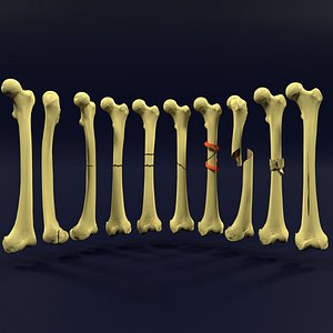 3D model types fractures