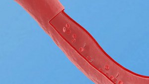 3D model Blood vesselsby Medical Premium