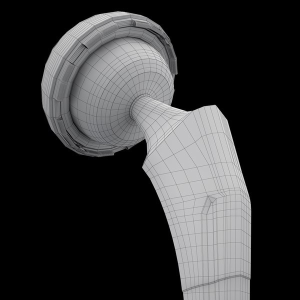 Femoral Prosthesis 3d Model