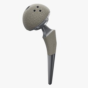 Femoral Prosthesis