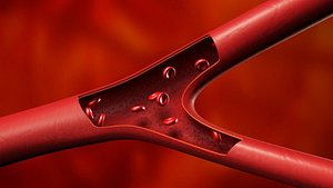 Artery Vein Clog Clot Clogged Stream Bloodflow Layers Section Anatomy