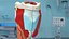 Larynx Medical Model Assembled