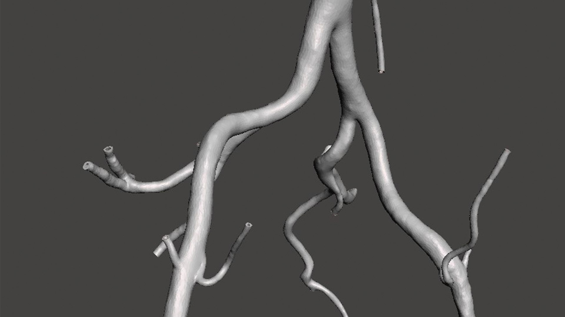 Aorta With Arteries 3D Model - TurboSquid 2125543