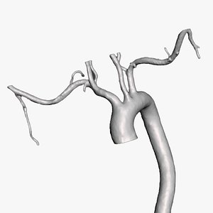 Aorta with arteries
