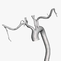 Aorta with arteries