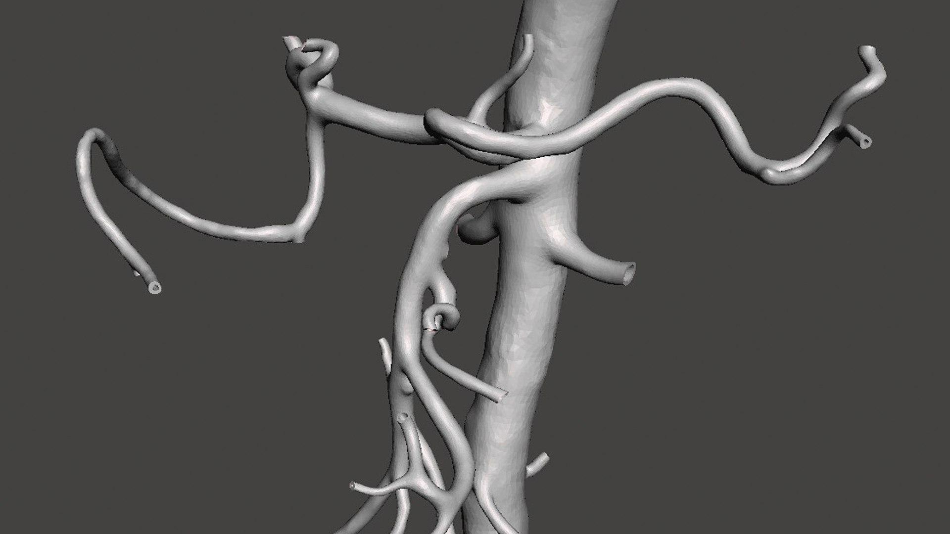 Aorta With Arteries 3D Model - TurboSquid 2125543