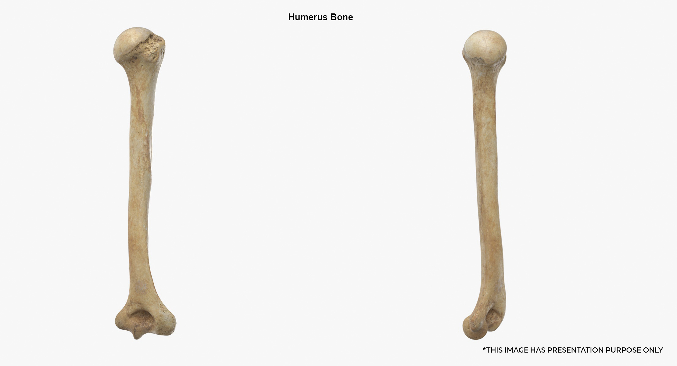 modelo 3d Human Arm Bones Hand Ulna Radius Humerus White and Yellow ...