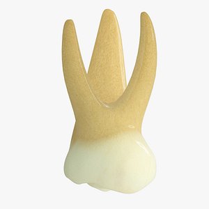 Upper Primary First Molar