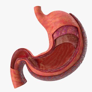 Stomach Anatomy cancer infected V01 3D model