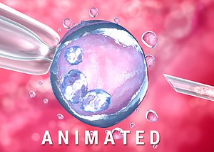 artificial insemination : glass 3D
