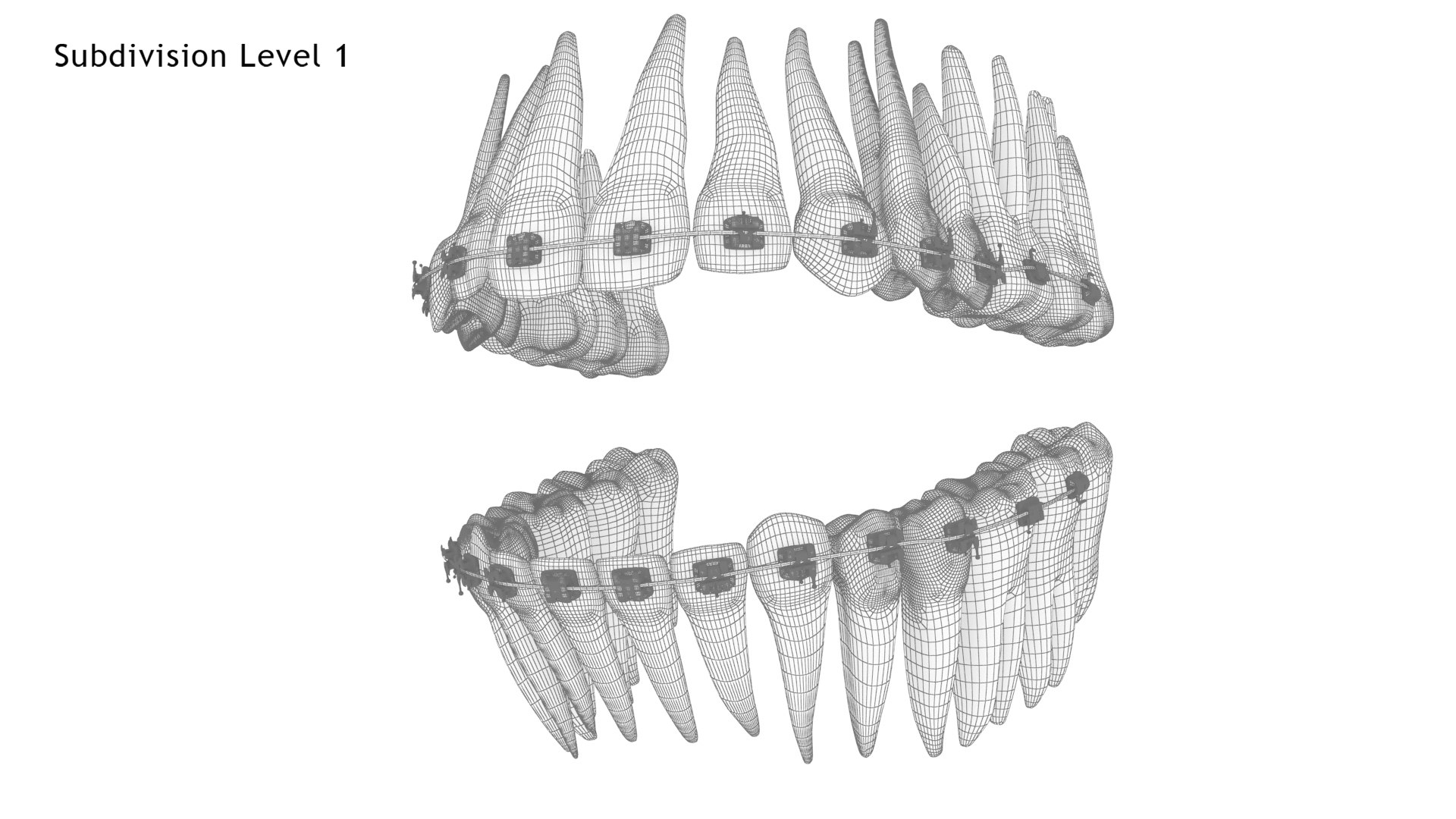 3D Human Teeth With Self Ligating Transparent Dental Braces V03 https://p.turbosquid.com/ts-thumb/zf/oACNt5/02/dentitionwithselfligatingsteeldentalbraces_wire2.1/jpg/1710865041/1920x1080/fit_q87/893f7b12a3bd86708ea0640718cf05b9dc872cdb/dentitionwithselfligatingsteeldentalbraces_wire2.1.jpg