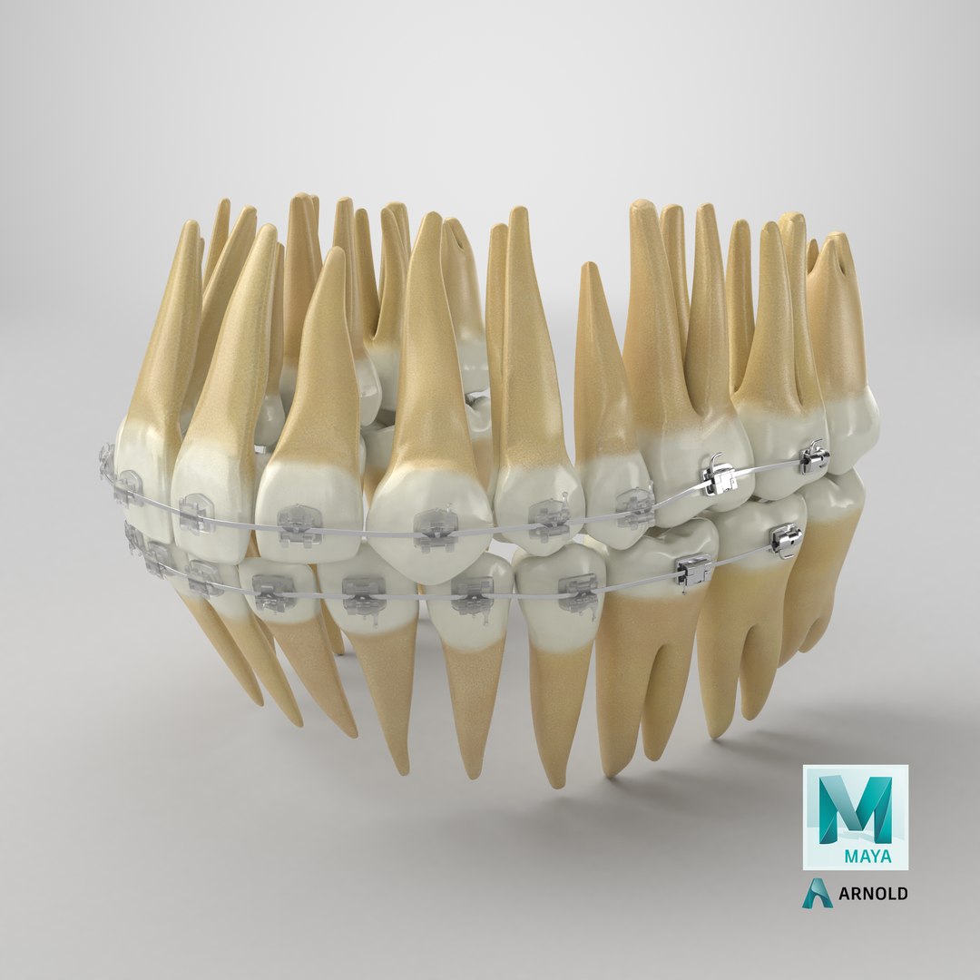 3D Human Teeth With Self Ligating Transparent Dental Braces V03 https://p.turbosquid.com/ts-thumb/zf/oACNt5/0E/stemcell_maya_arnold_render/png/1712315610/1920x1080/fit_q87/82191a04d8c949b87e71f00b629da79f78b190ce/stemcell_maya_arnold_render.jpg