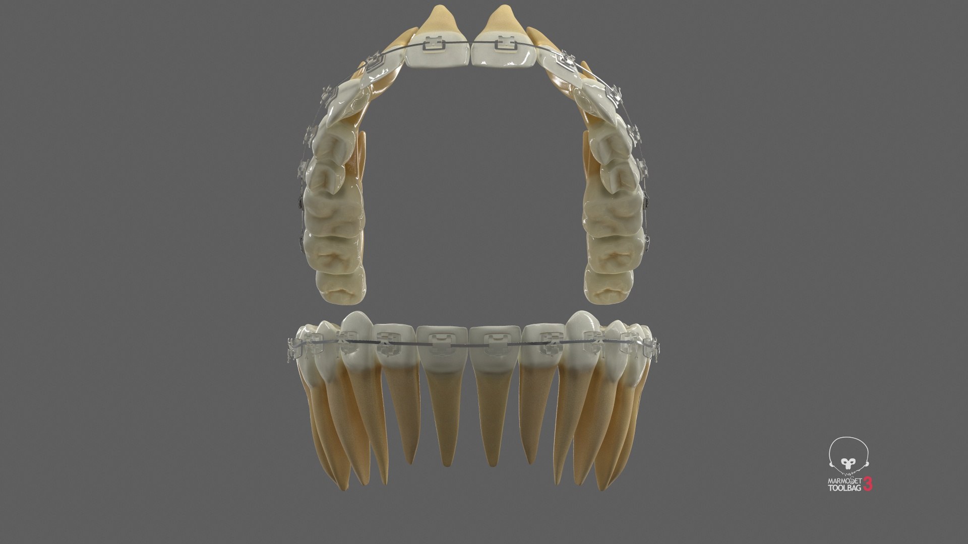 3D Human Teeth With Self Ligating Transparent Dental Braces V03 https://p.turbosquid.com/ts-thumb/zf/oACNt5/9T/screenshot005/jpg/1710865209/1920x1080/fit_q87/f9251447bac905d67108e5fb951c0f21738c26ff/screenshot005.jpg