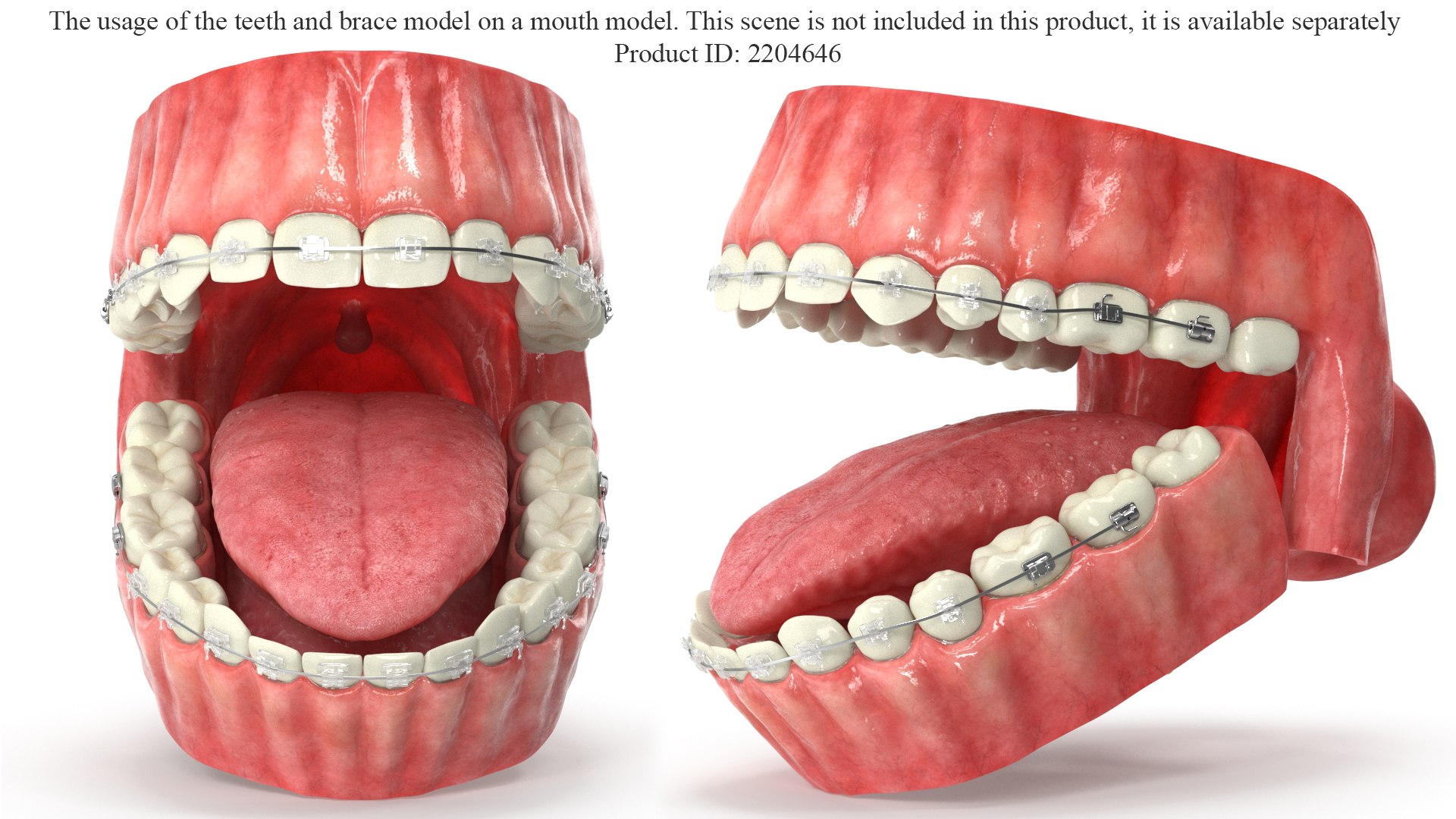 3D Human Teeth With Self Ligating Transparent Dental Braces V03 https://p.turbosquid.com/ts-thumb/zf/oACNt5/Aj/presentation/jpg/1710865379/1920x1080/fit_q87/1f577bccc86f81ac08fcb397c776a3f96c92c405/presentation.jpg
