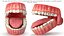 Denti umani con apparecchi dentali trasparenti autoleganti V03