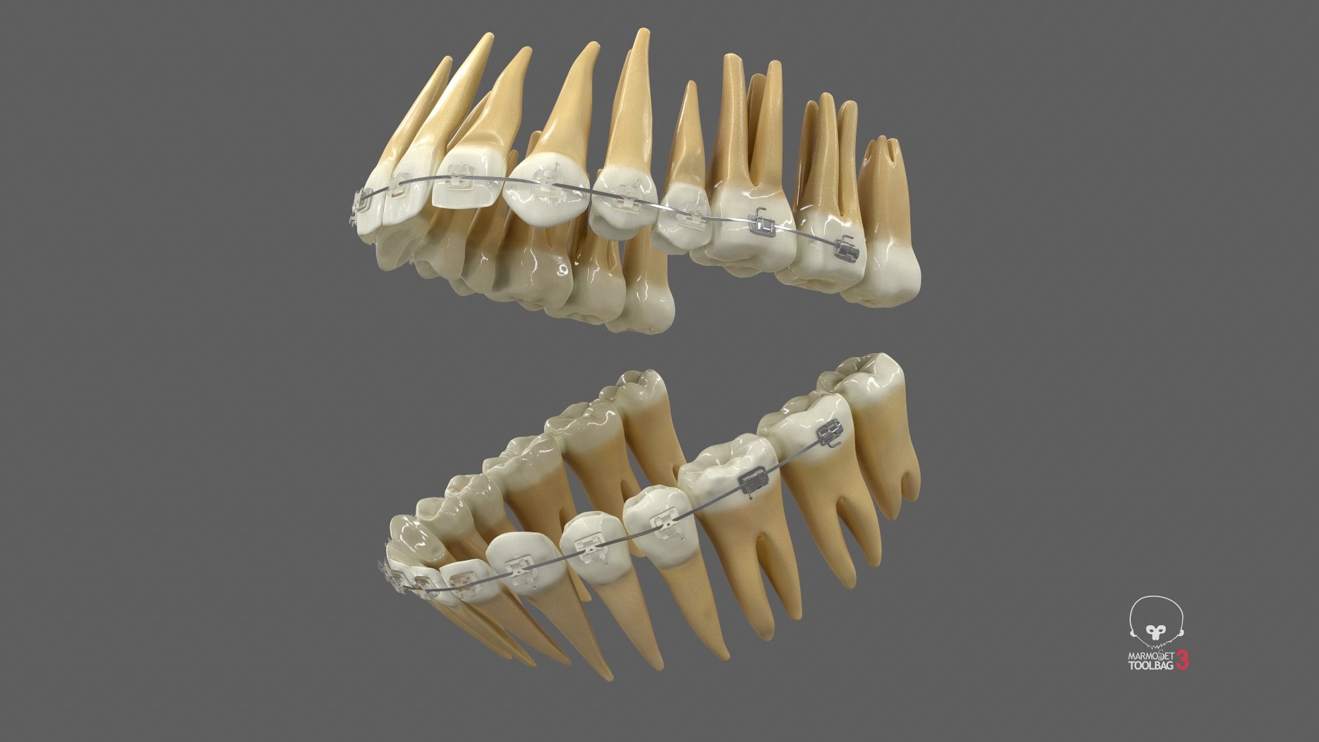 3D Human Teeth With Self Ligating Transparent Dental Braces V03 https://p.turbosquid.com/ts-thumb/zf/oACNt5/Bm/screenshot001/jpg/1710865199/1920x1080/fit_q87/d1a0589fe78db181554ed0aab4056838020b4ee7/screenshot001.jpg