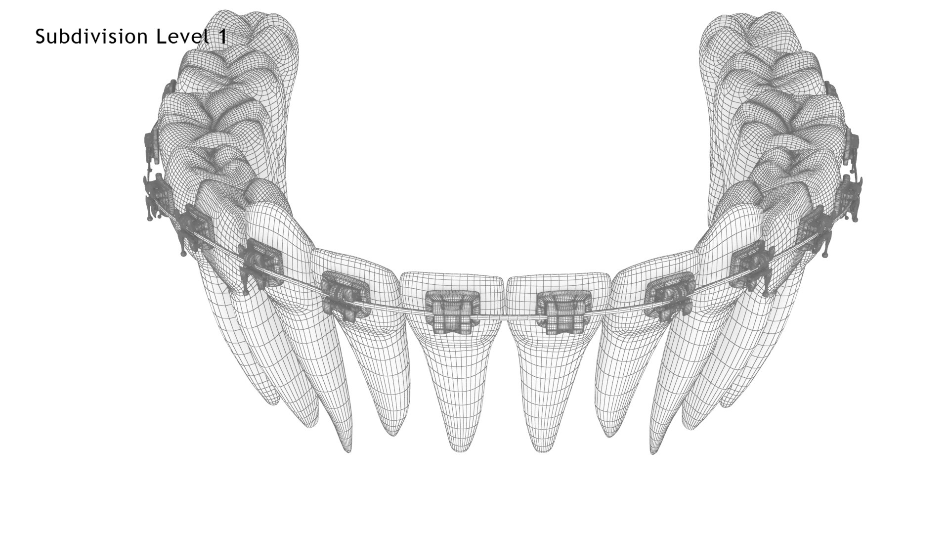 3D Human Teeth With Self Ligating Transparent Dental Braces V03 https://p.turbosquid.com/ts-thumb/zf/oACNt5/Gs/dentitionwithselfligatingsteeldentalbraces_wire4.1/jpg/1710865047/1920x1080/fit_q87/1422ee25d5d392445ce40ce22756c2dcace69222/dentitionwithselfligatingsteeldentalbraces_wire4.1.jpg
