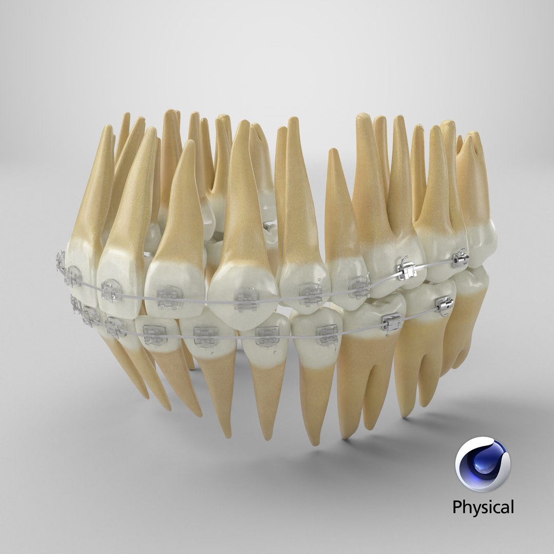 3D Human Teeth With Self Ligating Transparent Dental Braces V03 https://p.turbosquid.com/ts-thumb/zf/oACNt5/UL/stemcell_cinema_4d_physical_render/png/1712315617/1920x1080/fit_q87/bb2b7aca724f9b9e1cdb7439c501ddb7f36321ee/stemcell_cinema_4d_physical_render.jpg