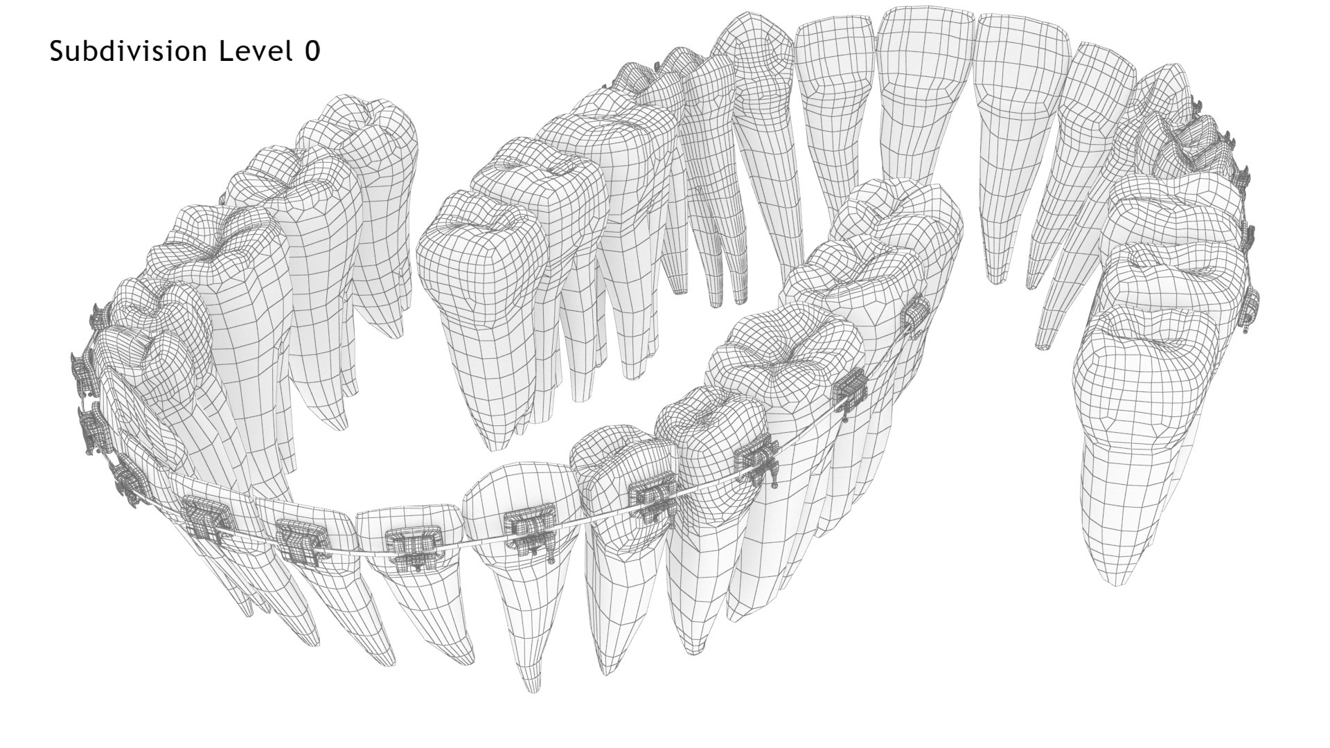 3D Human Teeth With Self Ligating Transparent Dental Braces V03 https://p.turbosquid.com/ts-thumb/zf/oACNt5/bK/dentitionwithselfligatingsteeldentalbraces_wire6.0/jpg/1710865050/1920x1080/fit_q87/3978e167f70b075d7e21f41d208e3de03fe459fb/dentitionwithselfligatingsteeldentalbraces_wire6.0.jpg