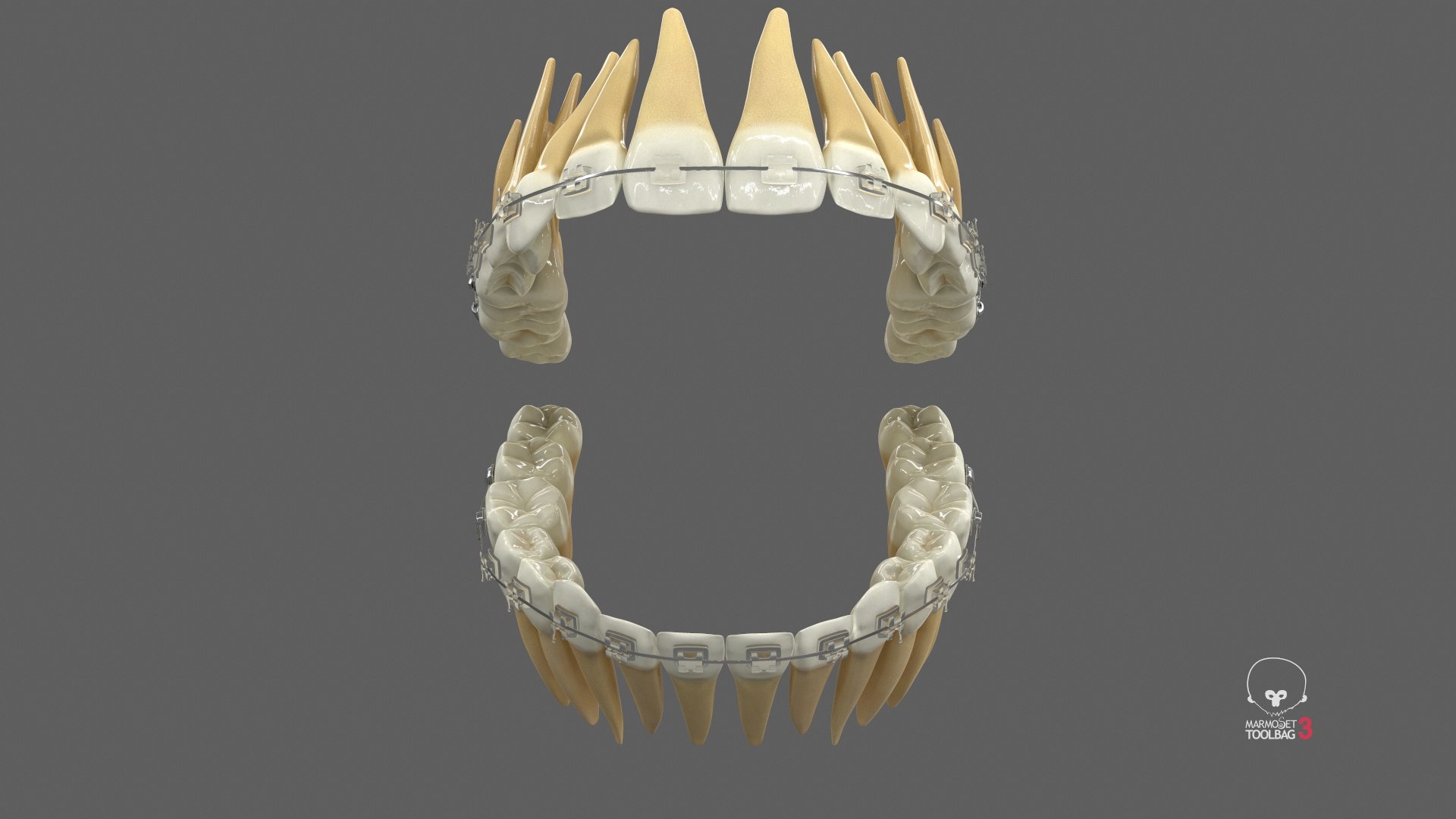 3D Human Teeth With Self Ligating Transparent Dental Braces V03 https://p.turbosquid.com/ts-thumb/zf/oACNt5/fn/screenshot000/jpg/1710865196/1920x1080/fit_q87/55f5dad8fe4c0b98d72b3ba9eae86376c96dcb10/screenshot000.jpg