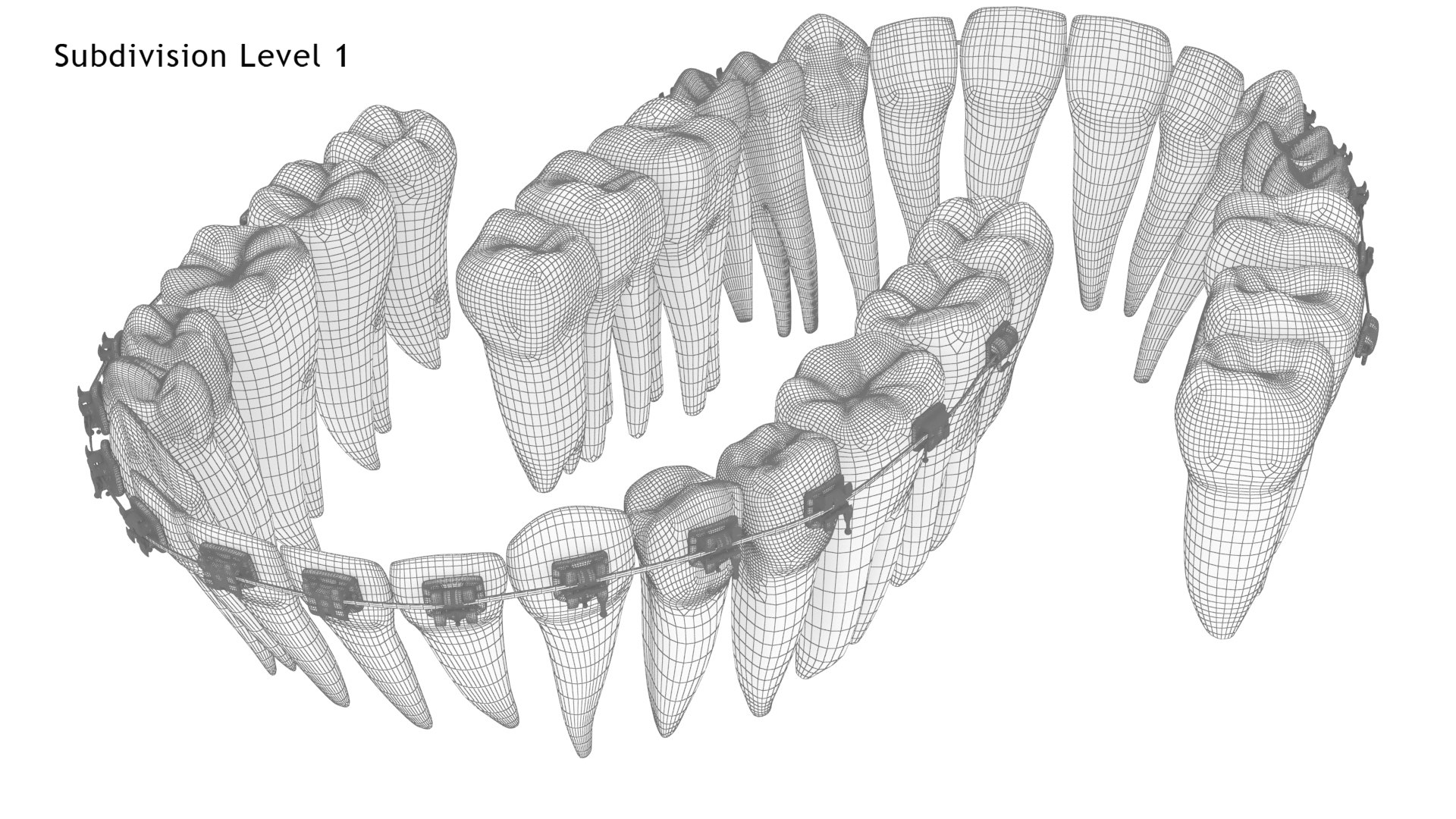 3D Human Teeth With Self Ligating Transparent Dental Braces V03 https://p.turbosquid.com/ts-thumb/zf/oACNt5/li/dentitionwithselfligatingsteeldentalbraces_wire6.1/jpg/1710865052/1920x1080/fit_q87/e00529c27c417ae6d24b4adf01e5d970e0f644ee/dentitionwithselfligatingsteeldentalbraces_wire6.1.jpg