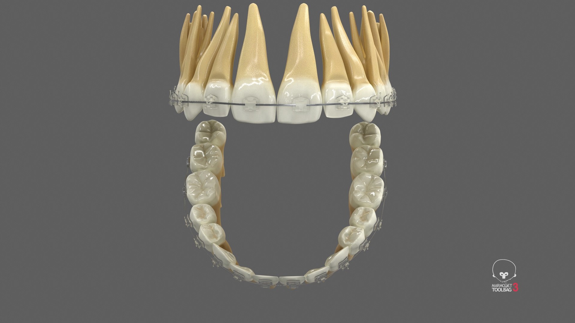 3D Human Teeth With Self Ligating Transparent Dental Braces V03 https://p.turbosquid.com/ts-thumb/zf/oACNt5/zV/screenshot004/jpg/1710865206/1920x1080/fit_q87/e8990df04ad9315e1ec07386e444e538ed4a2bdd/screenshot004.jpg