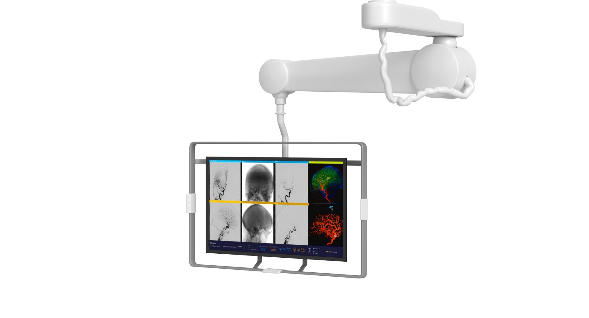 Siemens Healthineers Angiography Artis Model - TurboSquid 1577433