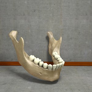 Lower Jaw Mandible Underhung