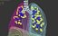 Lungs Animated